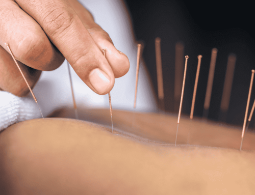 Finding Relief: How Acupuncture Supports Nerve Repair and Pain Management