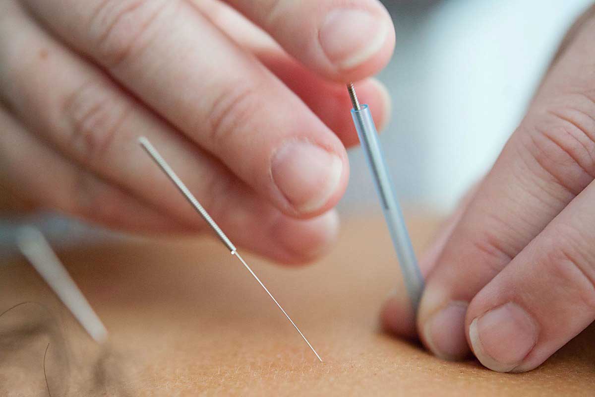 Aktiv Coast Healthcare - Acupuncture Services Tsawwassen